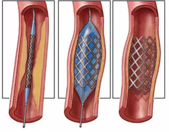愛旺工業(yè)醫(yī)療行業(yè)設(shè)備案例 愛旺工業(yè)醫(yī)療行業(yè)設(shè)備案例